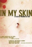 In My Skin